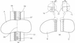 Figure R1020150055272