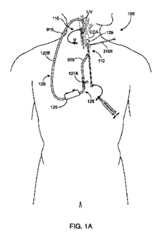 Figure 2024500772000001