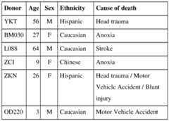 Figure imgf000041_0001