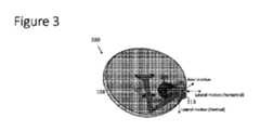 Figure 2023514436000001
