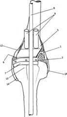 Figure GB2558543A_D0004