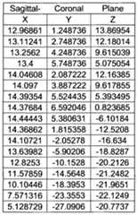 Figure imgf000012_0002