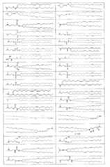 Figure BPA00001403431100151