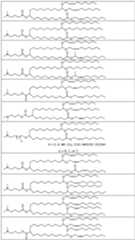 Figure imgf000124_0001