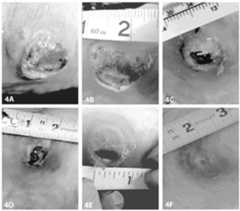 Figure imgf000018_0001