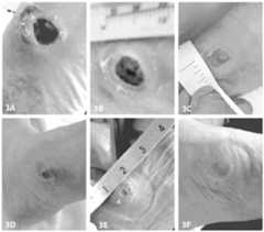 Figure imgf000016_0001