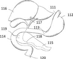 Figure AU2018282461A1_D0001