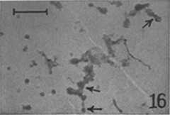 micrograph of a fraction containing microsome, see caption below