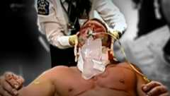 Paramedics tend to Triple H after his injury took place.