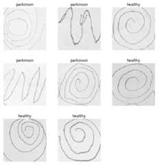 Parkinson-s-Disease-Classifier