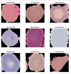 Malaria-Detection-with-Deep-Learning