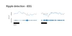 rippleDetection_IEEG