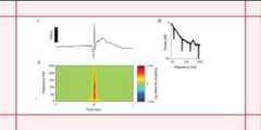 epilepticActivity_IEEG