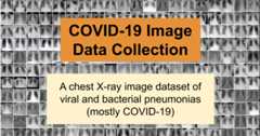 covid-chestxray-dataset