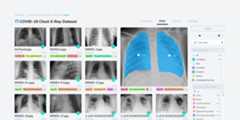 covid-19-xray-dataset