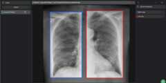 covid-19-chest-xray-lung-bounding-boxes-dataset