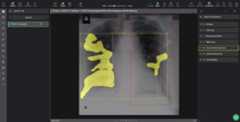 covid-19-chest-xray-segmentations-dataset