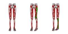 msk-bone-deformation