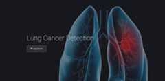 Lung-Cancer-Detection