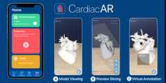 CardiacAR