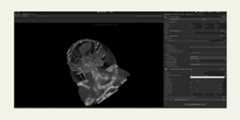 Unity-Dicom-3DRender