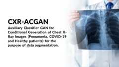 CXR-ACGAN-chest-xray-generator-covid19-pneumonia