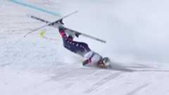 La esquiadora estadounidense Lindsey Vonn ha sido sometida a dos intervenciones quirúrgicas en las últimas horas después de sufrir una grave fractura de fémur durante su participación en los Juegos Olímpicos de invierno. La deportista decidió competir pese a arrastrar una reciente rotura de ligamentos, demostrando su carácter luchador y su compromiso con el deporte que la ha convertido en una de las figuras más admiradas del esquí alpino internacional. Sin embargo, su presencia en la pista terminó en una aparatosa caída apenas iniciada la prueba, un accidente que dejó impactados tanto a los espectadores presentes como a millones de seguidores que seguían la competición desde todo el mundo. Tras el incidente, fue trasladada de inmediato a un hospital cercano, donde los especialistas evaluaron la gravedad de sus lesiones y decidieron intervenirla quirúrgicamente en dos ocasiones para estabilizar la fractura y evitar complicaciones futuras. Actualmente, la atleta permanece ingresada y evoluciona favorablemente, acompañada por su equipo médico y sus seres queridos. Además agradeció el constante apoyo de aficionados. Desde la cama del hospital, Vonn compartió un mensaje público en el que aseguró que no se arrepiente de haber competido, incluso siendo consciente de los riesgos que implicaba su decisión personal.
