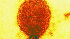 Las autoridades sanitarias indias trabajan contrarreloj para frenar un nuevo foco del virus Nipah detectado en Bengala Occidental, en el este del país, después de que se confirmaran cinco contagios y se aislara de forma preventiva a alrededor de un centenar de personas. Este nuevo episodio ha vuelto a encender las alertas en la región por tratarse de uno de los virus más mortíferos conocidos, con una letalidad que puede llegar hasta el 75% y frente al cual no existe, por ahora, ni vacuna ni tratamiento específico.Dos de los casos confirmados son enfermeras de un hospital privado situado a unos 25 kilómetros de Calcuta. Ambas coincidieron en sus turnos entre el 28 y el 30 de diciembre y comenzaron a desarrollar síntomas graves -como fiebre alta y problemas respiratorios- pocos días después. El 4 de enero fueron trasladadas a la unidad de cuidados intensivos debido al rápido empeoramiento de su estado; una de ellas continúa en coma.