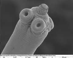 tapeworm-new.jpg