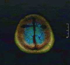 brain2.gif