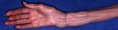 arm3.jpg