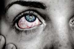 алергичен-конюнктивит