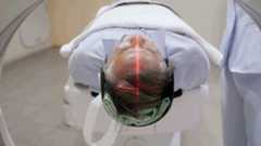 Hidden brain condition may quadruple dementia risk in older adults, study suggests