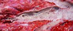 Lungworm in a deer trachea
