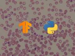 How to Perform Malaria Classification using TensorFlow 2 and Keras in Python