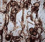 Fungal filaments