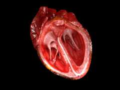 Tempat ketiga: Model 3D keratan rentas janaan komputer bagi jantung.– Pengiktirafan: DrJanaOfficial (CC BY-SA 4.0)