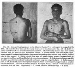 As a result of numerous instances of the new .38 service pistols being ineffective the US Army was forced to hastily re-issue mothballed Single Action Amy .45 Colts.