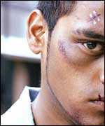 man with injuries