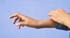 Remedios caseros contra los picores de la dermatitis