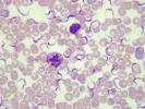 Trypanosoma