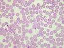 Trypanosoma