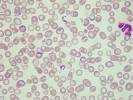 Trypanosoma