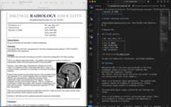 Converting MRI report to Markdown