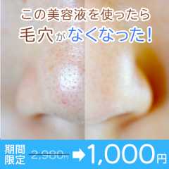 NG例