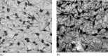 FIGURE 2.2. A high-power photomicrograph of PH-8-immunoreacted sections of human brain stem from an age- and sex-matched control (a) and suicide (b).