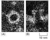 Figure 25-43. Electron micrographs of negatively stained complement lesions in the plasma membrane of a red blood cell.