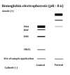 α-Thalassemia Major on Hemoglobin Electrophoresis