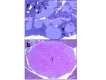 Figure 3. . From Crabtree and others with permission (32): “Pancreatic lesions in Men1 TSM/+ mice.