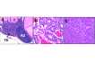 Figure 4. . From Crabtree and others with permission (32): “Other lesions in Men1 TSM/+ mice.